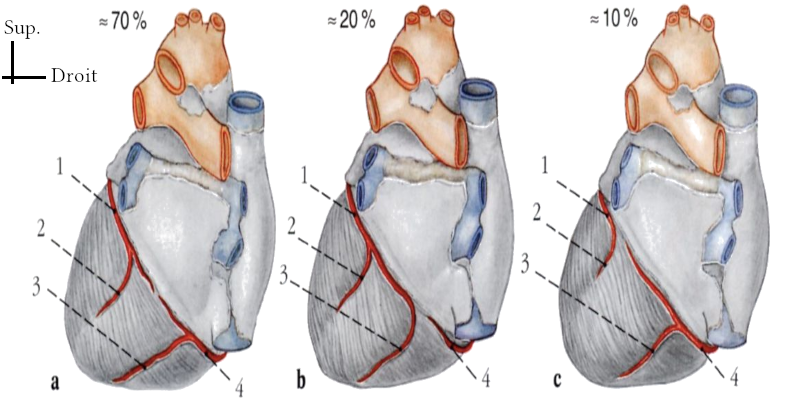 Variations anatomique des artères coronaires