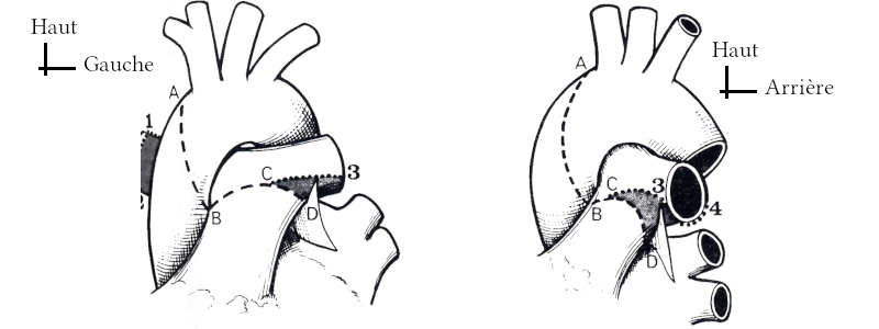 Dessin du hile artériel