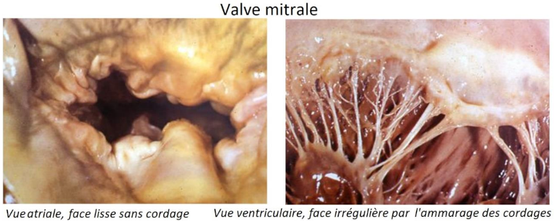 Photos de la valve mitrale