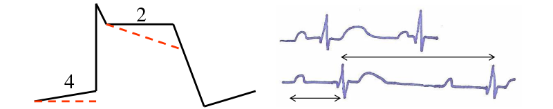 Effets cardiaques du vérapamil