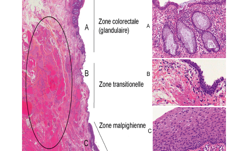 Image histologique du canal anal