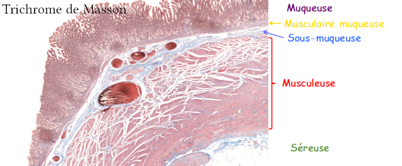 Image de la paroi gastrique