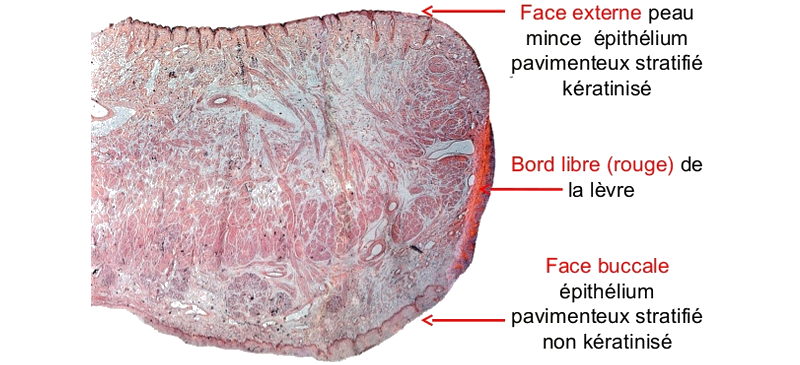 Coupe histologique d’une lèvre