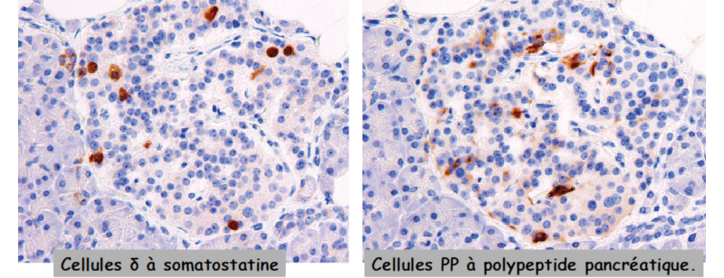 Cellules neuroendocrines du pancréas