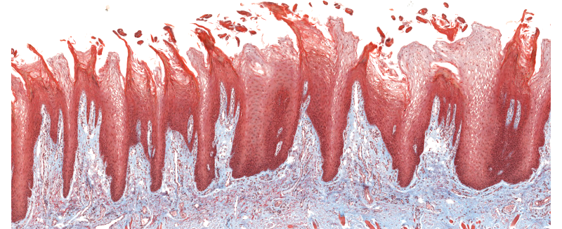 Image histologique des papilles filiformes