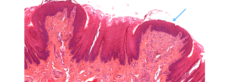 Image histologique des papilles fongiformes