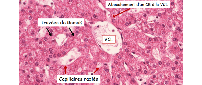 Travées de Remak