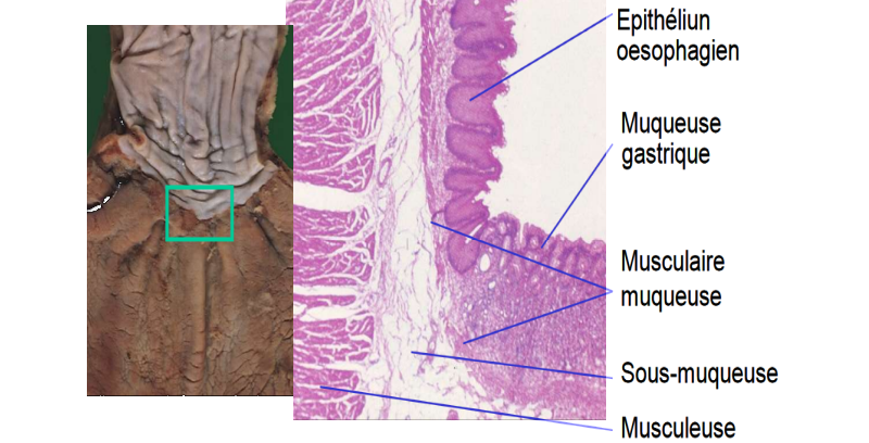 Image de la transition œusophage estomac