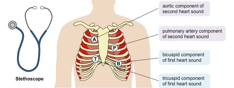 Auscultation cardiaque