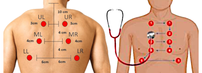 Auscultation pulmonaire