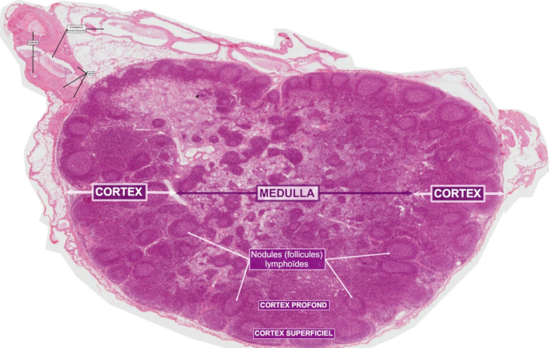 Coupe d’un ganglion lymphatique au microscope