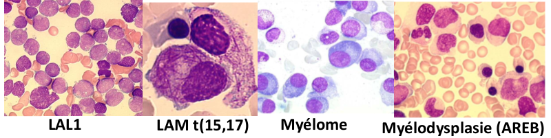 Pathologies