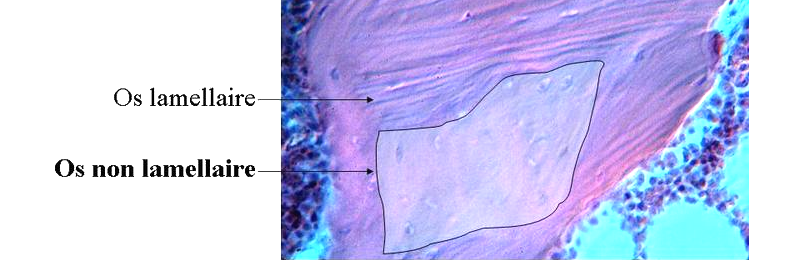 Image de l’os primaire