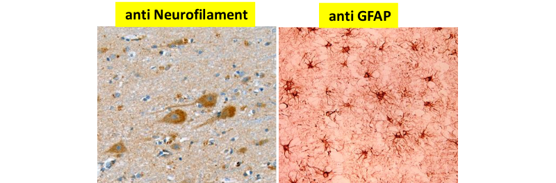 Coupe en immunohistochimie