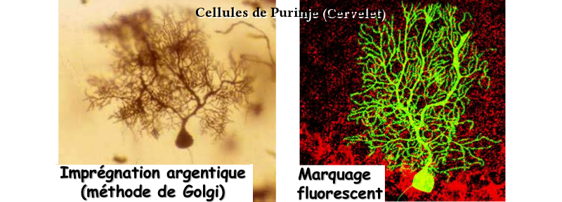 Image des dendrites