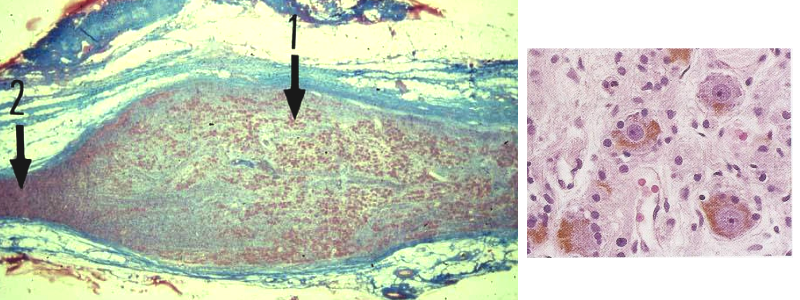 Histologie d’un ganglion nerveux